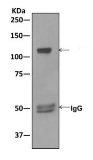 Immunoprecipitation - Anti-NFkB p100/NFKB2 antibody [EPR4686-66] (ab175192), expandable thumbnail