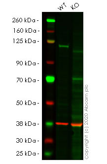Western blot - Anti-NFkB p100/NFKB2 antibody [EPR4686-66] (AB175192), expandable thumbnail
