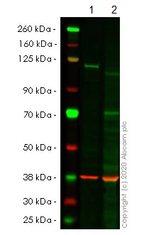 Western blot - Anti-NFkB p100/NFKB2 antibody [EPR4686-66] (ab175192), expandable thumbnail