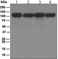 Western blot - Anti-NFkB p100/NFKB2 antibody [EPR4686] (AB109440)