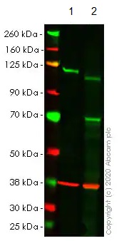 Western blot - Anti-NFkB p100/NFKB2 antibody [EPR4686] (ab109440), expandable thumbnail