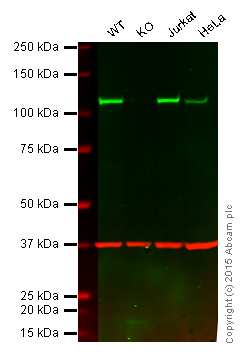 Western blot - Anti-NFkB p100/NFKB2 antibody [EPR4686] (AB109440), expandable thumbnail