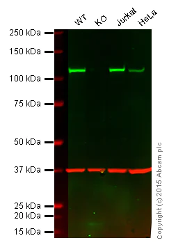 Western blot - Anti-NFkB p100/NFKB2 antibody [EPR4686] (AB109440)