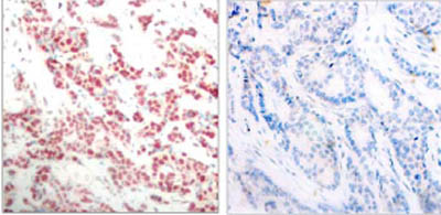 Immunohistochemistry (Formalin/PFA-fixed paraffin-embedded sections) - Anti-NFkB p100/NFKB2 (phospho S865) antibody (AB31474)