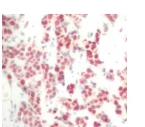 Immunohistochemistry (Formalin/PFA-fixed paraffin-embedded sections) - Anti-NFkB p100/NFKB2 (phospho S866) antibody (AB194919)