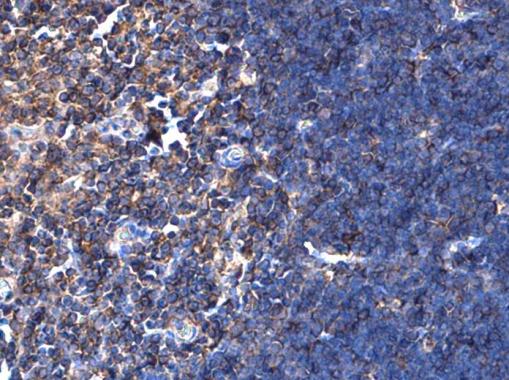 Immunohistochemistry (Formalin/PFA-fixed paraffin-embedded sections) - Anti-NFkB p100 / p52 antibody (AB227078), expandable thumbnail