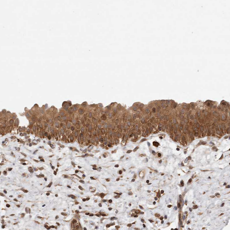 Immunohistochemistry (Formalin/PFA-fixed paraffin-embedded sections) - Anti-NFkB p105 / p50 antibody (AB209795)