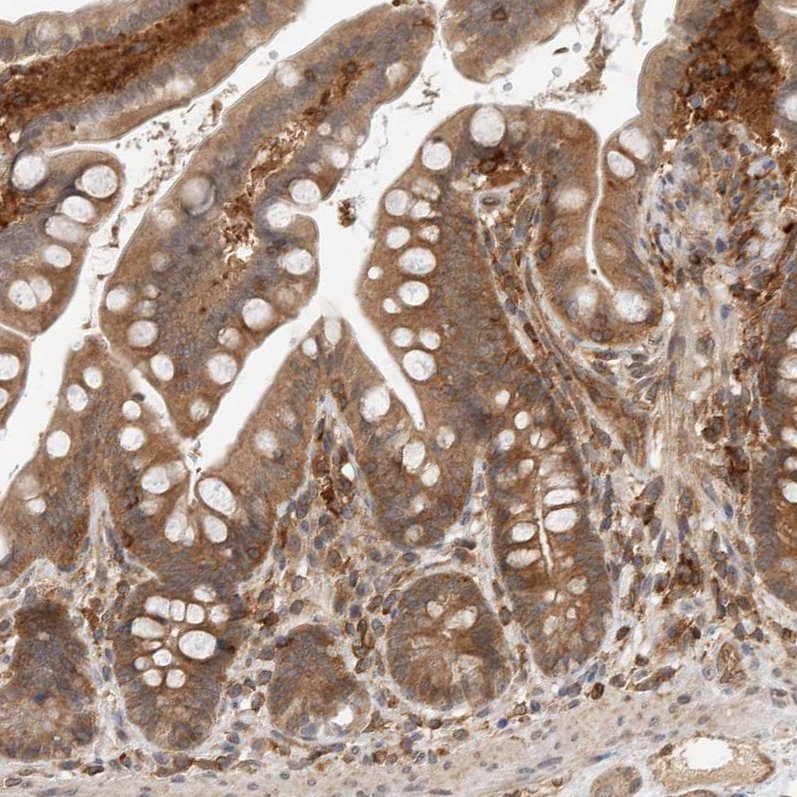 Immunohistochemistry (Formalin/PFA-fixed paraffin-embedded sections) - Anti-NFkB p105 / p50 antibody (AB209795)