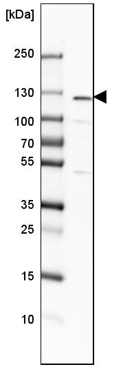 Western blot - Anti-NFkB p105 / p50 antibody (AB209795)