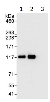 Immunoprecipitation - Anti-NFkB p105 / p50 antibody (AB264235)