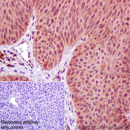 Immunohistochemistry (Formalin/PFA-fixed paraffin-embedded sections) - Anti-NFkB p105 / p50 antibody [E381] (AB32360)