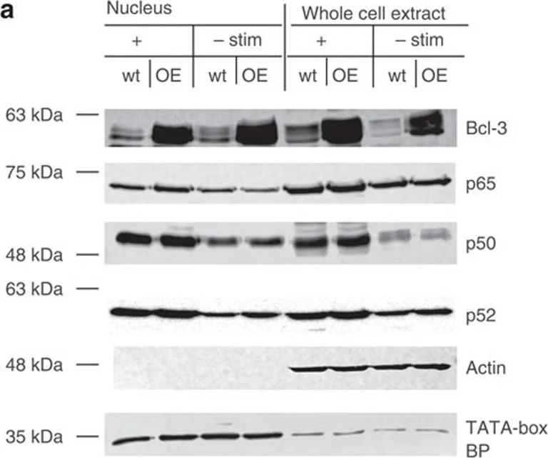 Western blot - Anti-NFkB p105 / p50 antibody [E381] (AB32360)