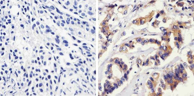 Immunohistochemistry (Formalin/PFA-fixed paraffin-embedded sections) - Anti-NFkB p105 / p50 antibody [RP23040086] (AB313430)