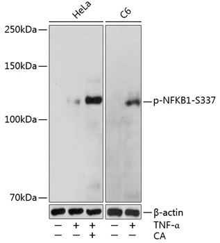 Western blot - Anti-NFkB p105 / p50 (phospho S337) antibody (AB194729)