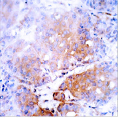 Immunohistochemistry (Formalin/PFA-fixed paraffin-embedded sections) - Anti-NFkB p105 / p50 (phospho S337) antibody (AB28849)