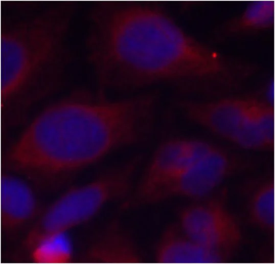 Immunocytochemistry/ Immunofluorescence - Anti-NFkB p105 / p50 (phospho S893) antibody (AB194931)