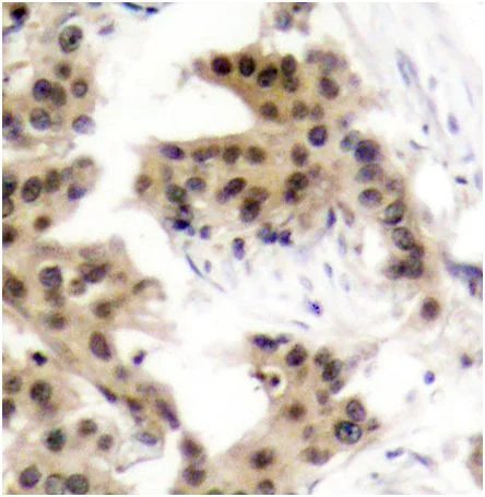 Immunohistochemistry (Formalin/PFA-fixed paraffin-embedded sections) - Anti-NFkB p105 / p50 (phospho S893) antibody (AB194931)