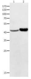 Western blot - Anti-NFKBID antibody (AB182633), expandable thumbnail