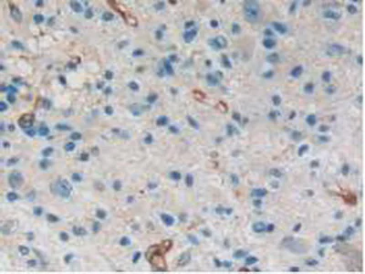 Immunohistochemistry (Formalin/PFA-fixed paraffin-embedded sections) - Anti-NFKBID antibody (AB232913)