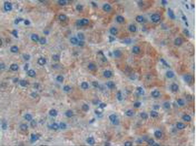 Immunohistochemistry (Formalin/PFA-fixed paraffin-embedded sections) - Anti-NFKBID antibody (AB232913)