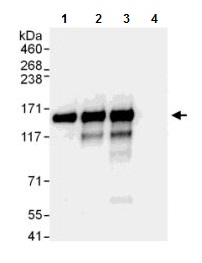 Immunoprecipitation - Anti-NFX1 antibody (AB176733), expandable thumbnail