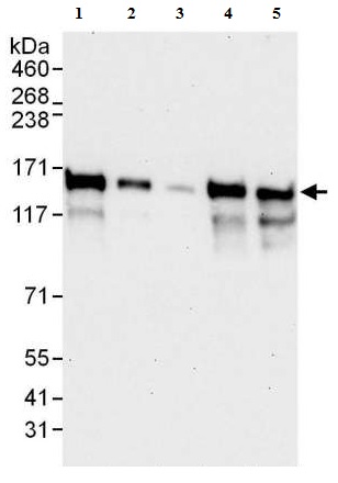 Western blot - Anti-NFX1 antibody (AB176733), expandable thumbnail
