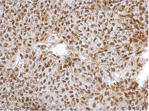 Immunohistochemistry (Formalin/PFA-fixed paraffin-embedded sections) - Anti-NFYA antibody (AB154554)