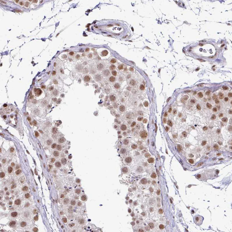 Immunohistochemistry (Formalin/PFA-fixed paraffin-embedded sections) - Anti-NFYA Antibody (AB327236)