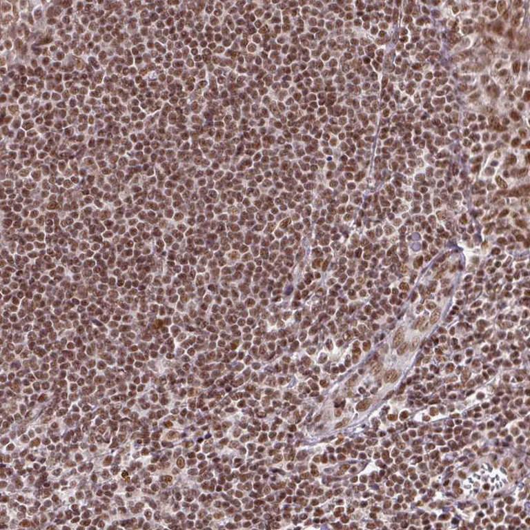 Immunohistochemistry (Formalin/PFA-fixed paraffin-embedded sections) - Anti-NFYA Antibody (AB327236)