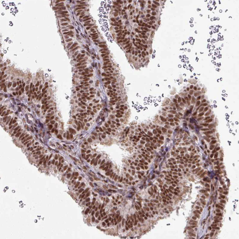 Immunohistochemistry (Formalin/PFA-fixed paraffin-embedded sections) - Anti-NFYA Antibody (AB327236)