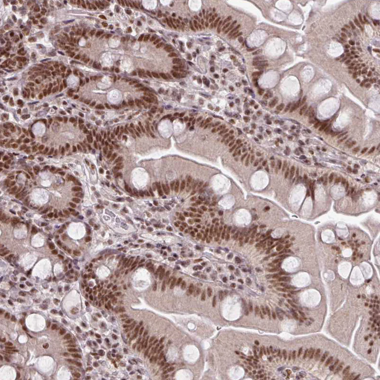 Immunohistochemistry (Formalin/PFA-fixed paraffin-embedded sections) - Anti-NFYA Antibody (AB327236)