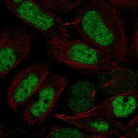 Immunocytochemistry/ Immunofluorescence - Anti-NFYB Antibody (AB327263)