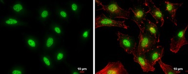 Immunocytochemistry/ Immunofluorescence - Anti-NFYB/CBF-B antibody (AB111577)