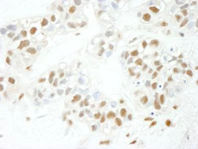 Immunohistochemistry (Formalin/PFA-fixed paraffin-embedded sections) - Anti-NFYC antibody (AB104258)