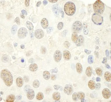 Immunohistochemistry (Formalin/PFA-fixed paraffin-embedded sections) - Anti-NFYC antibody (AB104258)