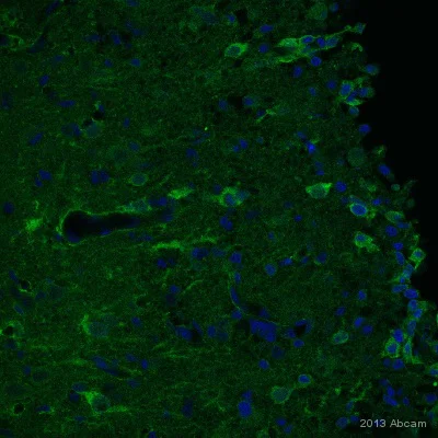 Immunohistochemistry (PFA perfusion fixed frozen sections) - Anti-NG2 antibody (AB83178)