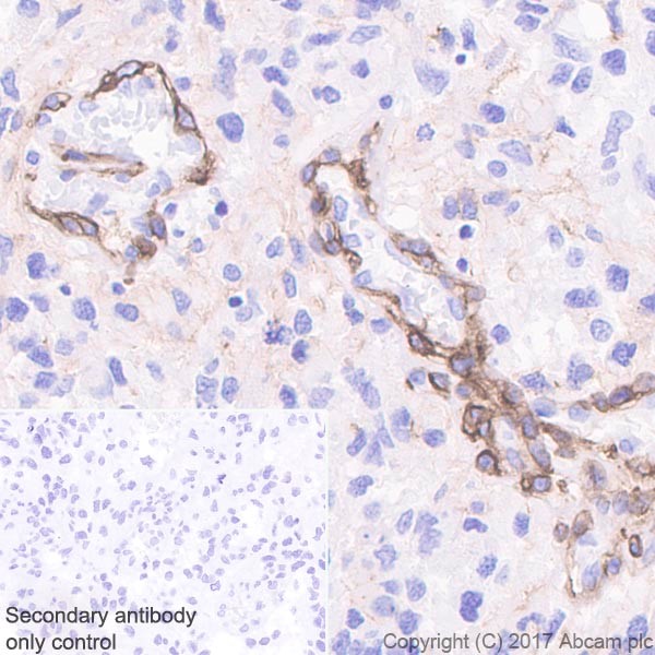 Immunohistochemistry (Formalin/PFA-fixed paraffin-embedded sections) - Anti-NG2 antibody [EPR20244] - BSA and Azide free (AB226865), expandable thumbnail