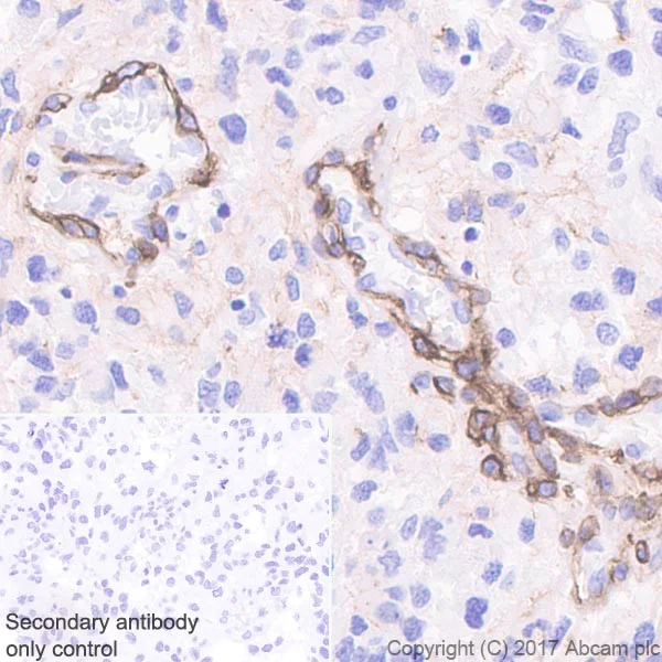 Immunohistochemistry (Formalin/PFA-fixed paraffin-embedded sections) - Anti-NG2 antibody [EPR20244] - BSA and Azide free (AB226865)