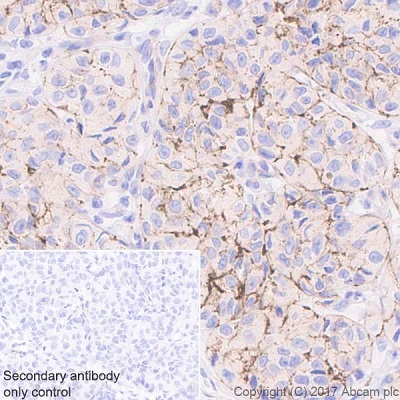 Immunohistochemistry (Formalin/PFA-fixed paraffin-embedded sections) - Anti-NG2 antibody [EPR20244] - BSA and Azide free (AB226865), expandable thumbnail