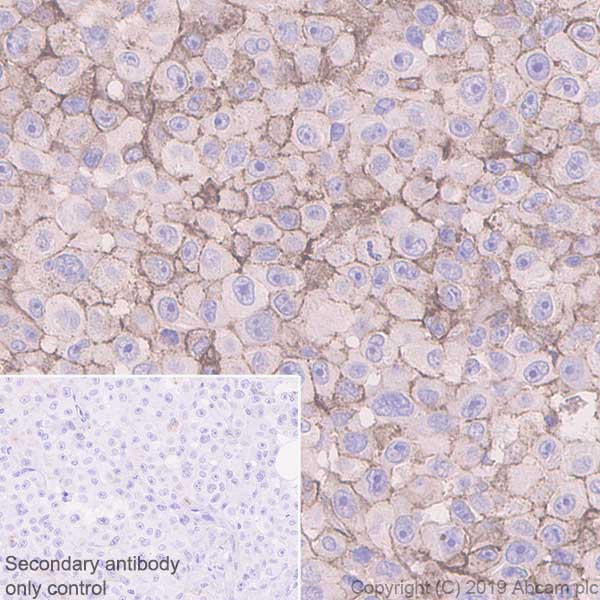 Immunohistochemistry (Formalin/PFA-fixed paraffin-embedded sections) - Anti-NG2 antibody [EPR22410-145] (AB255811), expandable thumbnail