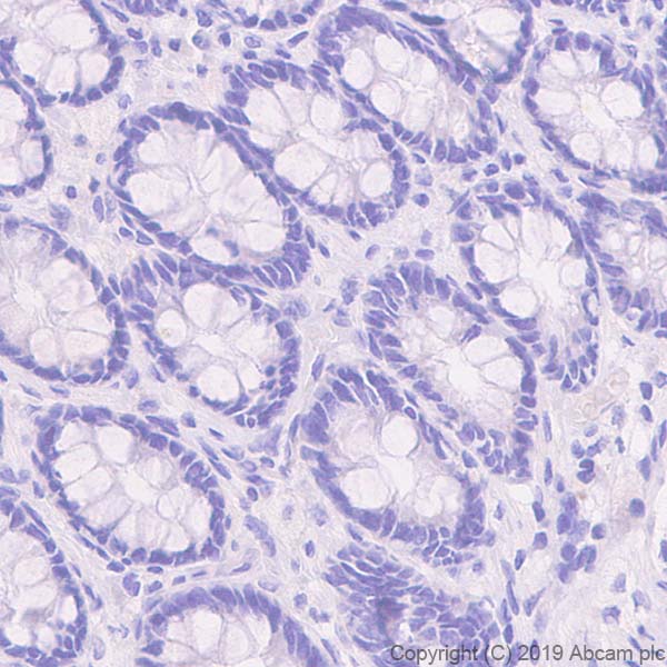 Immunohistochemistry (Formalin/PFA-fixed paraffin-embedded sections) - Anti-NG2 antibody [EPR22410-145] (ab255811), expandable thumbnail