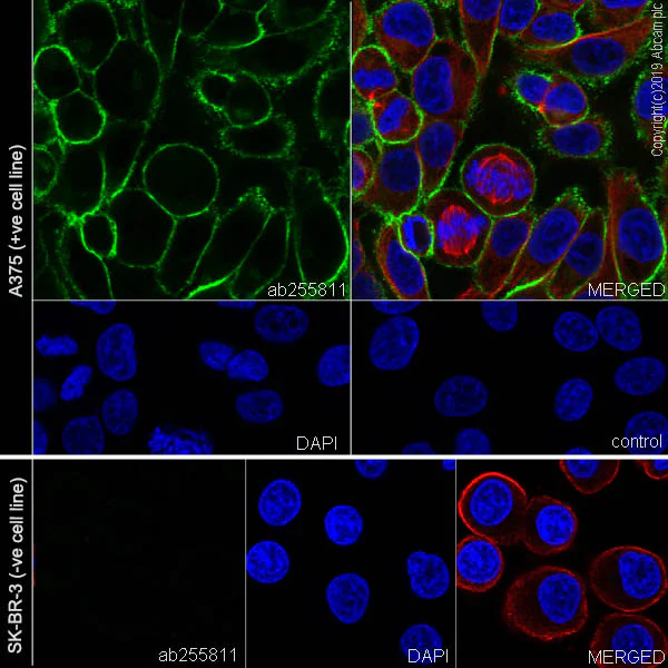 Immunocytochemistry/ Immunofluorescence - Anti-NG2 antibody [EPR22410-145] - BSA and Azide free (AB256351)