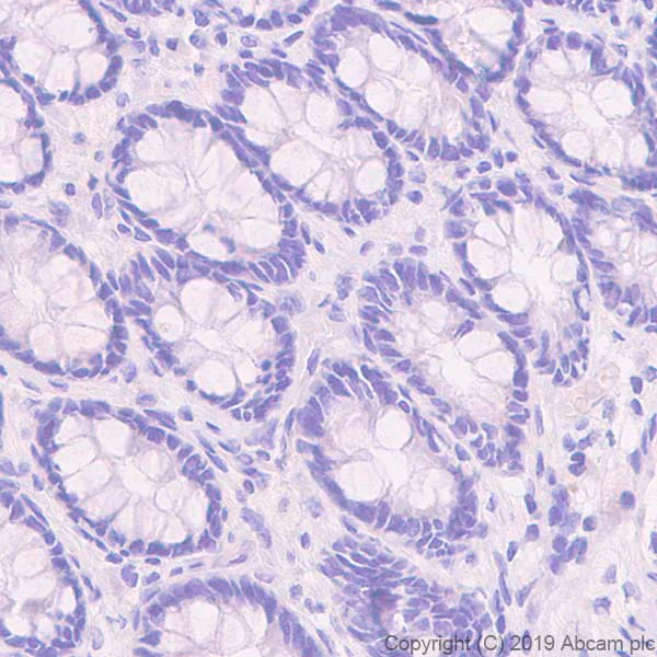 Immunohistochemistry (Formalin/PFA-fixed paraffin-embedded sections) - Anti-NG2 antibody [EPR22410-145] - BSA and Azide free (AB256351)