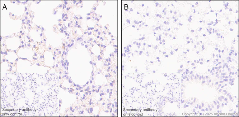 Immunohistochemistry (Formalin/PFA-fixed paraffin-embedded sections) - Anti-NG2 antibody [EPR23752-147] - BSA and Azide free (AB275041)