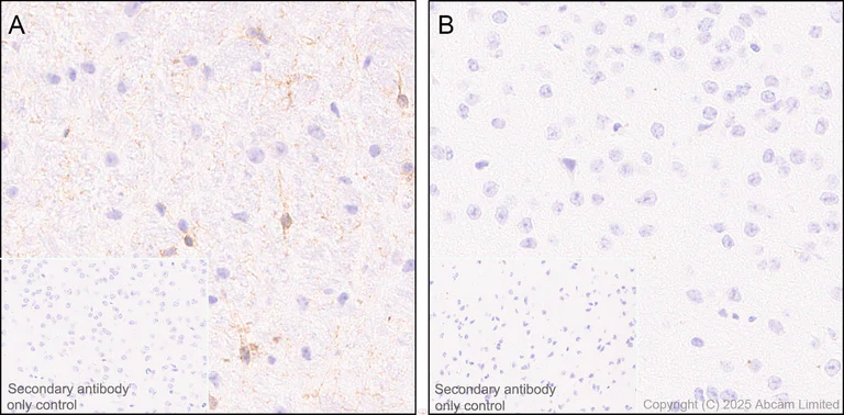Immunohistochemistry (Formalin/PFA-fixed paraffin-embedded sections) - Anti-NG2 antibody [EPR23752-147] - BSA and Azide free (AB275041)
