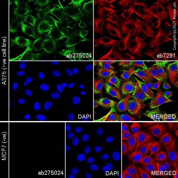 Immunocytochemistry/ Immunofluorescence - Anti-NG2 antibody [EPR23976-145] (AB275024), expandable thumbnail