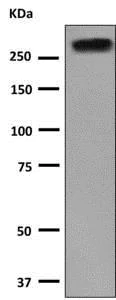 Western blot - Anti-NG2 antibody [EPR9195] (AB139406)