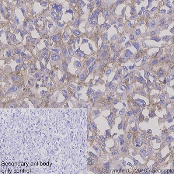 Immunohistochemistry (Formalin/PFA-fixed paraffin-embedded sections) - Anti-NG2 antibody [EPR9195] - BSA and Azide free (AB240112), expandable thumbnail