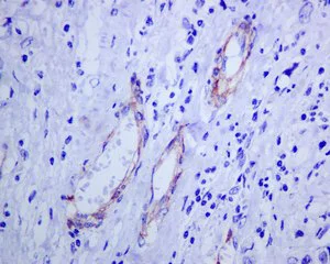 Immunohistochemistry (Formalin/PFA-fixed paraffin-embedded sections) - Anti-NG2 antibody [EPR9195] - BSA and Azide free (AB240112)
