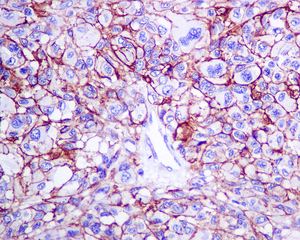 Immunohistochemistry (Formalin/PFA-fixed paraffin-embedded sections) - Anti-NG2 antibody [EPR9195] - BSA and Azide free (AB240112), expandable thumbnail